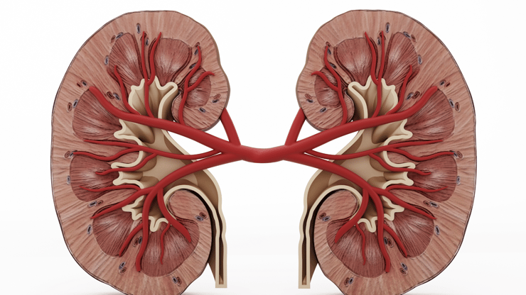 Acute Kidney Injury nclex prep