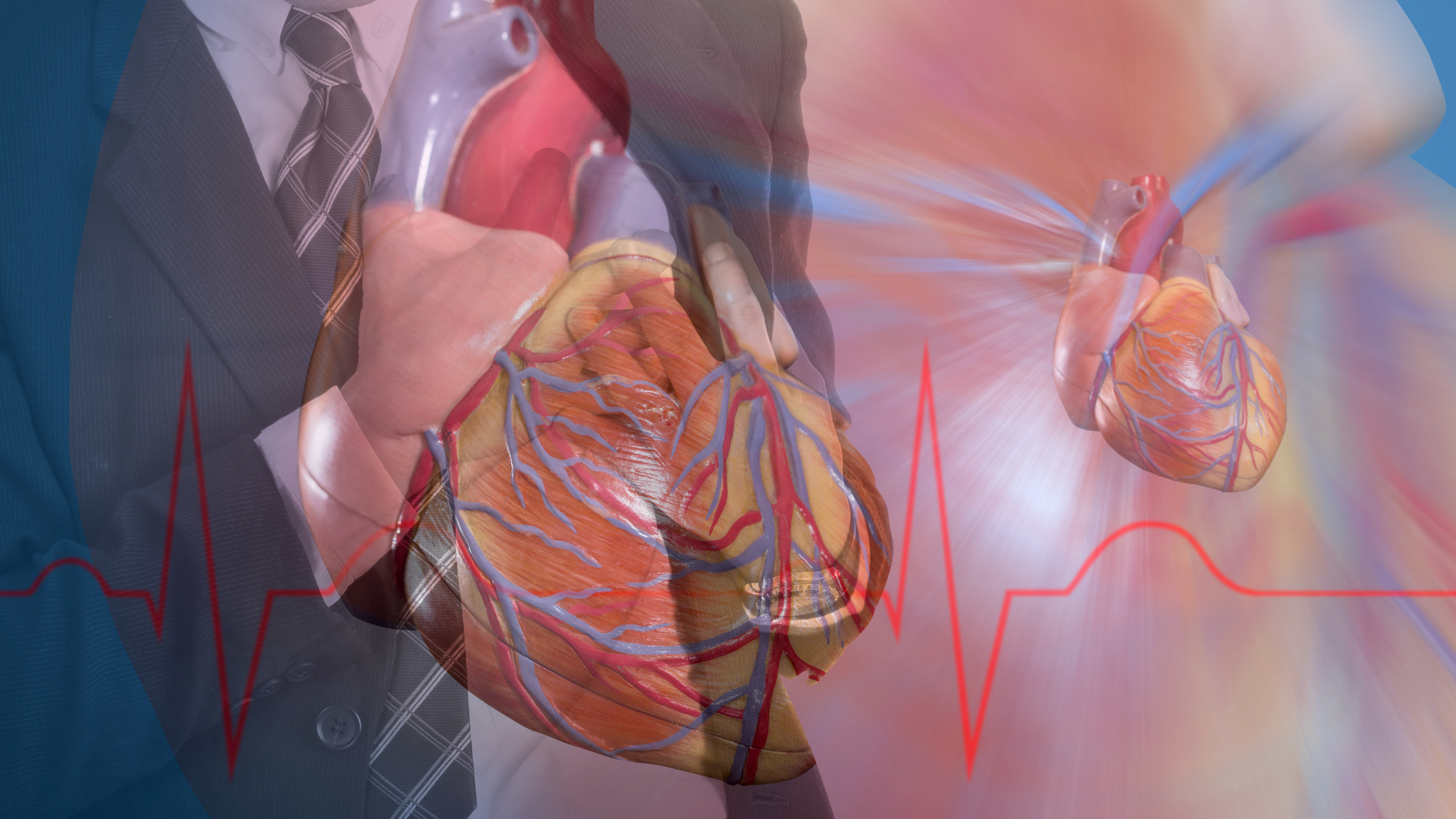 Cardiogenic Shock nursing nclex review for nursing students