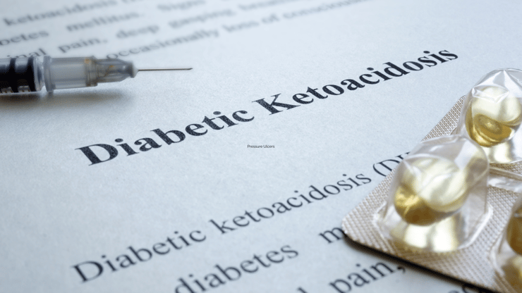 Diabetic Ketoacidosis nclex prep