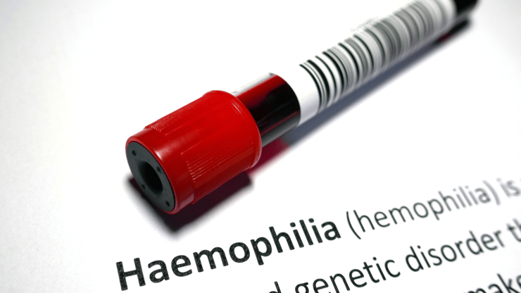 Hemophilia nclex review