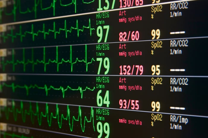 how to read ecg strips