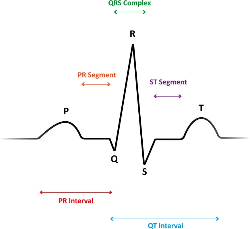 ECG waveform EKG 