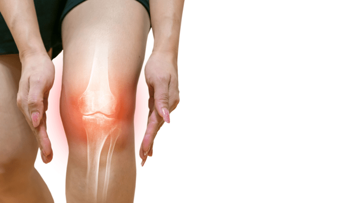 Osteoarthritis nclex prep