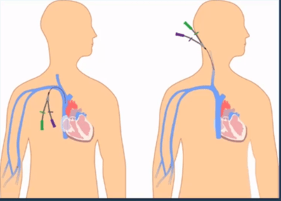 LPN IV certification