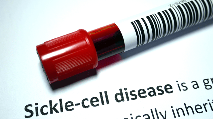sickle cell anemia nclex prep